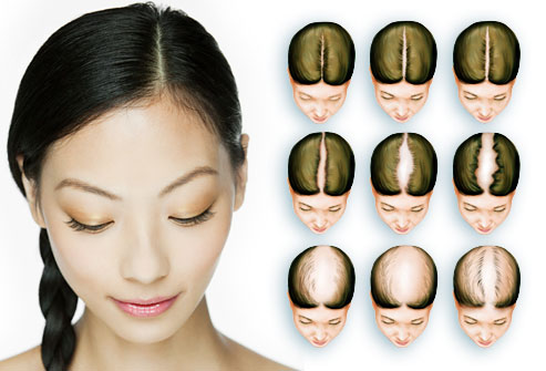 how to regrow hair in hindi